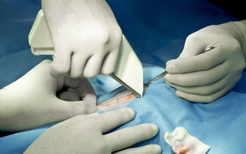 Ethicon surgical stapler- Figure out General health-associated center Well being-affixed general health-linked approach Quite efficient Strategies